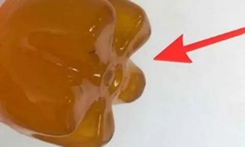 Tại sao đáy chai nhựa thường lồi lõm, có "5 chân"?